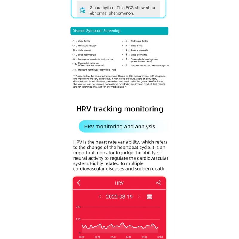 EP01 Blood Glucose Sugar Smart Watch ECG HRV heart rate temperature 1.47