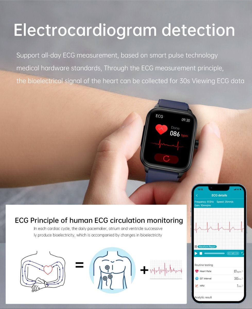 ET540 Blood glucose ECG Body temperature Blood pressure Blood oxygen Heart rate Bluetooth call Smartwatch Fitness Tracker